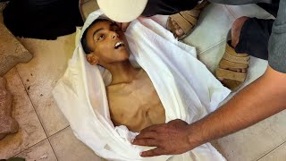 تشييع جثمان الطفل عبد الجواد الغلبان الذي قضى بسبب سوء التغذية في خان يونس جنوب قطاع غزة