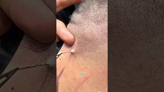 Чуть не умер от волоса😱