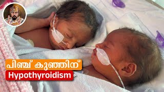 HYPOTHYROIDISM IN NEW BORN/CONGENITAL HYPOTHYROIDISM/ MEDICATIONS/ TREATMENT/ SYMPTOMS