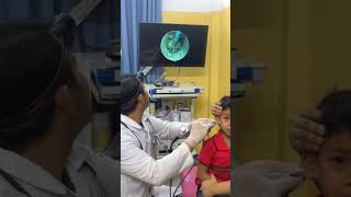 Exploring the Ear Canal – Endoscopic Journey! 🚀👂 #ENTDoctor #HealthCare #ent