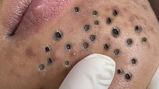 𝑭𝒓𝒐𝒎 𝑺𝒓𝒆𝒔𝒔𝒆𝒅 𝒕𝒐 𝑺𝒆𝒓𝒆𝒏𝒆 : 𝑯𝒐𝒘 𝒂 𝑹𝒆𝒍𝒂𝒙𝒊𝒏𝒈 𝑺𝒌𝒊𝒏𝒄𝒂𝒓𝒆 𝑹𝒐𝒖𝒕𝒊𝒏𝒆 𝑪𝒂𝒍𝒎𝒔 𝒀𝒐𝒖𝒓 𝑴𝒊𝒏𝒅 𝑨𝒏𝒅 𝑺𝒐𝒖𝒍 #𝟗𝟗𝟔𝟕𝟐