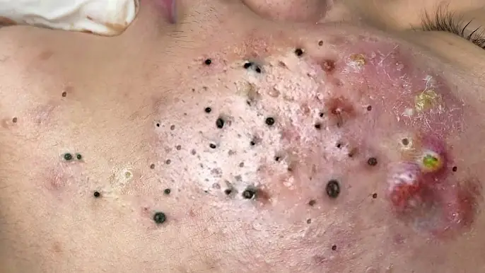 سر الجمال مع العناية الفاخرة بالبشرة في السبا الجديد#541511