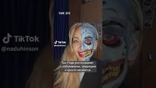 Как живет женщина с исчезающим лицом