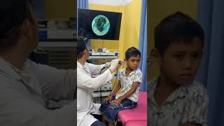 Doctor Removes Giant Earwax Blockage! 😱👂 #ENT #EarCare #Doctor