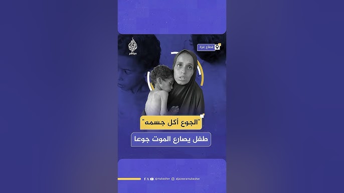 "الجوع أكل جسمه أكل عضمه يزن بموت".. صرخة أم فلسطينية يصارع طفلها الموت جراء سوء التغذية