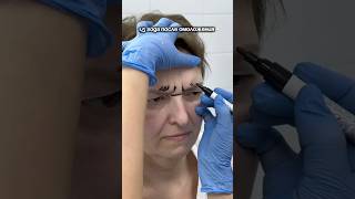 Не бабушка 70 лет, а мама в 50🥹 1,5 года после комплексного омоложения! Доктор НИКОЛАЕВА С.А.