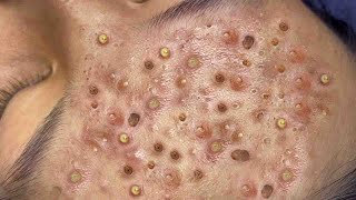 𝑭𝒓𝒐𝒎 𝑺𝒓𝒆𝒔𝒔𝒆𝒅 𝒕𝒐 𝑺𝒆𝒓𝒆𝒏𝒆 : 𝑯𝒐𝒘 𝒂 𝑹𝒆𝒍𝒂𝒙𝒊𝒏𝒈 𝑺𝒌𝒊𝒏𝒄𝒂𝒓𝒆 𝑹𝒐𝒖𝒕𝒊𝒏𝒆 𝑪𝒂𝒍𝒎𝒔 𝒀𝒐𝒖𝒓 𝑴𝒊𝒏𝒅 𝑨𝒏𝒅 𝑺𝒐𝒖𝒍 #𝟗𝟗𝟔𝟕𝟑