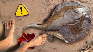 가오리 쏘임 – 지금까지 중 최악?! (100만 특별)