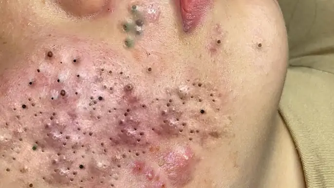 عناية رائعة بالبشرة مع سبا جديد #𝐒𝐤𝐢𝐧𝐜𝐚𝐫𝐞 9988551