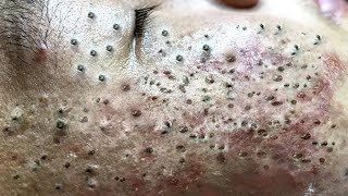 𝘾𝙖𝙡𝙢 𝙔𝙤𝙪𝙧 𝙈𝙞𝙣𝙙, 𝙍𝙚𝙛𝙧𝙚𝙨𝙝 𝙔𝙤𝙪𝙧 𝙎𝙠𝙞𝙣:𝙃𝙤𝙬 𝘾𝙡𝙚𝙖𝙣𝙨𝙞𝙣𝙜 𝙍𝙚𝙡𝙖𝙭𝙚𝙨 𝙔𝙤𝙪𝙧 𝙎𝙤𝙪𝙡 #𝟗𝟖𝟖𝟔𝟕