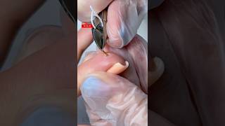 ЗАНОЗА БЫЛА ВНУТРИ 5 дней 🫢 КАК ОНО ТАМ ПОМЕСТИЛОСЬ? #nipponnippers