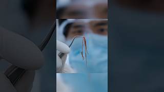 Стоматолог нашёл во рту пациента нечто ужасное