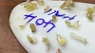 عناية رائعة بالبشرة مع سبا جديد #𝐒𝐤𝐢𝐧𝐜𝐚𝐫𝐞 𝟗𝟕𝟏𝟗𝟔