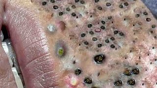 𝘾𝙖𝙡𝙢 𝙔𝙤𝙪𝙧 𝙈𝙞𝙣𝙙, 𝙍𝙚𝙛𝙧𝙚𝙨𝙝 𝙔𝙤𝙪𝙧 𝙎𝙠𝙞𝙣:𝙃𝙤𝙬 𝘾𝙡𝙚𝙖𝙣𝙨𝙞𝙣𝙜 𝙍𝙚𝙡𝙖𝙭𝙚𝙨 𝙔𝙤𝙪𝙧 𝙎𝙤𝙪𝙡 #𝟗𝟖𝟖𝟔𝟏