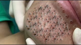 𝙁𝙧𝙤𝙢 𝙎𝙩𝙧𝙚𝙨𝙨𝙚𝙙 𝙩𝙤 𝙎𝙚𝙧𝙚𝙣𝙚: 𝙃𝙤𝙬 𝙖 𝙍𝙚𝙡𝙖𝙭𝙞𝙣𝙜 𝙎𝙠𝙞𝙣𝙘𝙖𝙧𝙚 𝙍𝙤𝙪𝙩𝙞𝙣𝙚 𝘾𝙖𝙡𝙢𝙨 𝙔𝙤𝙪𝙧 𝙈𝙞𝙣𝙙 𝙖𝙣𝙙 𝙎𝙤𝙪𝙡 #𝟗𝟖𝟗𝟏𝟏