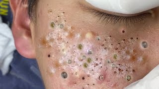 𝘾𝙖𝙡𝙢 𝙔𝙤𝙪𝙧 𝙈𝙞𝙣𝙙, 𝙍𝙚𝙛𝙧𝙚𝙨𝙝 𝙔𝙤𝙪𝙧 𝙎𝙠𝙞𝙣:𝙃𝙤𝙬 𝘾𝙡𝙚𝙖𝙣𝙨𝙞𝙣𝙜 𝙍𝙚𝙡𝙖𝙭𝙚𝙨 𝙔𝙤𝙪𝙧 𝙎𝙤𝙪𝙡 #𝟗𝟖𝟖𝟔𝟐