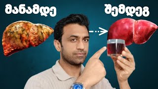 ღვიძლი სარკესავით სუფთა იქნება, თუ ამას ღამით დალევთ