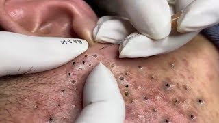 𝑭𝒓𝒐𝒎 𝑺𝒓𝒆𝒔𝒔𝒆𝒅 𝒕𝒐 𝑺𝒆𝒓𝒆𝒏𝒆 : 𝑯𝒐𝒘 𝒂 𝑹𝒆𝒍𝒂𝒙𝒊𝒏𝒈 𝑺𝒌𝒊𝒏𝒄𝒂𝒓𝒆 𝑹𝒐𝒖𝒕𝒊𝒏𝒆 𝑪𝒂𝒍𝒎𝒔 𝒀𝒐𝒖𝒓 𝑴𝒊𝒏𝒅 𝑨𝒏𝒅 𝑺𝒐𝒖𝒍 #𝟗𝟗𝟔𝟖𝟐