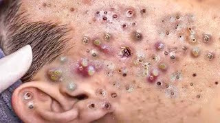 𝑭𝒓𝒐𝒎 𝑺𝒓𝒆𝒔𝒔𝒆𝒅 𝒕𝒐 𝑺𝒆𝒓𝒆𝒏𝒆 : 𝑯𝒐𝒘 𝒂 𝑹𝒆𝒍𝒂𝒙𝒊𝒏𝒈 𝑺𝒌𝒊𝒏𝒄𝒂𝒓𝒆 𝑹𝒐𝒖𝒕𝒊𝒏𝒆 𝑪𝒂𝒍𝒎𝒔 𝒀𝒐𝒖𝒓 𝑴𝒊𝒏𝒅 𝑨𝒏𝒅 𝑺𝒐𝒖𝒍 #946376