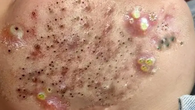 سر الجمال مع العناية الفاخرة بالبشرة في السبا الجديد#541533