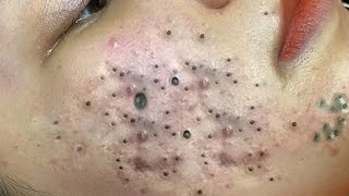 𝘾𝙖𝙡𝙢 𝙔𝙤𝙪𝙧 𝙈𝙞𝙣𝙙, 𝙍𝙚𝙛𝙧𝙚𝙨𝙝 𝙔𝙤𝙪𝙧 𝙎𝙠𝙞𝙣:𝙃𝙤𝙬 𝘾𝙡𝙚𝙖𝙣𝙨𝙞𝙣𝙜 𝙍𝙚𝙡𝙖𝙭𝙚𝙨 𝙔𝙤𝙪𝙧 𝙎𝙤𝙪𝙡 #𝟗𝟖𝟖𝟔𝟓