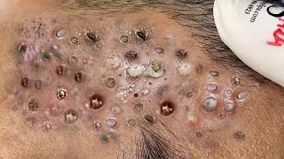 𝑭𝒓𝒐𝒎 𝑺𝒓𝒆𝒔𝒔𝒆𝒅 𝒕𝒐 𝑺𝒆𝒓𝒆𝒏𝒆 : 𝑯𝒐𝒘 𝒂 𝑹𝒆𝒍𝒂𝒙𝒊𝒏𝒈 𝑺𝒌𝒊𝒏𝒄𝒂𝒓𝒆 𝑹𝒐𝒖𝒕𝒊𝒏𝒆 𝑪𝒂𝒍𝒎𝒔 𝒀𝒐𝒖𝒓 𝑴𝒊𝒏𝒅 𝑨𝒏𝒅 𝑺𝒐𝒖𝒍 #𝟗𝟗𝟔𝟕𝟏