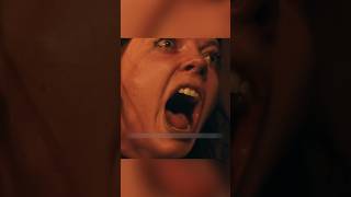 قصة الفتاة التي قطعت أصابع قدميها #شفا #قصص #قصص_واقعية #حكمة #قصص_اطفال