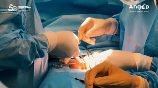 Ministra destaca sucesso na separação de gémeas siamesas no país