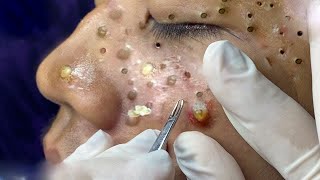 𝘾𝙖𝙡𝙢 𝙔𝙤𝙪𝙧 𝙈𝙞𝙣𝙙, 𝙍𝙚𝙛𝙧𝙚𝙨𝙝 𝙔𝙤𝙪𝙧 𝙎𝙠𝙞𝙣:𝙃𝙤𝙬 𝘾𝙡𝙚𝙖𝙣𝙨𝙞𝙣𝙜 𝙍𝙚𝙡𝙖𝙭𝙚𝙨 𝙔𝙤𝙪𝙧 𝙎𝙤𝙪𝙡 #𝟗𝟖𝟖𝟔𝟑