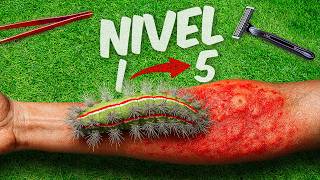 애벌레 레벨 1~5! 도전에 실패했다!