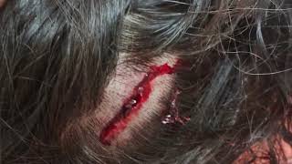 Dangriga Woman Claims Assault, Says Police Ignored Her Report