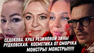 Уголовное дело Седоковой. Цирк Рудковской. Утяшева эскорт для Винер. Дибровы Товстики! Волочкова ОР!