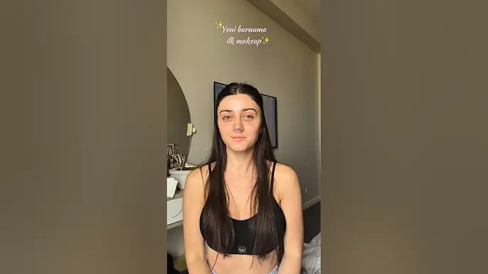 Yeni burun 😊 #azərbaycan #yeni #fyp #shorts