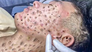 𝑭𝒓𝒐𝒎 𝑺𝒓𝒆𝒔𝒔𝒆𝒅 𝒕𝒐 𝑺𝒆𝒓𝒆𝒏𝒆 : 𝑯𝒐𝒘 𝒂 𝑹𝒆𝒍𝒂𝒙𝒊𝒏𝒈 𝑺𝒌𝒊𝒏𝒄𝒂𝒓𝒆 𝑹𝒐𝒖𝒕𝒊𝒏𝒆 𝑪𝒂𝒍𝒎𝒔 𝒀𝒐𝒖𝒓 𝑴𝒊𝒏𝒅 𝑨𝒏𝒅 𝑺𝒐𝒖𝒍 #94630