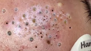 𝘾𝙖𝙡𝙢 𝙔𝙤𝙪𝙧 𝙈𝙞𝙣𝙙, 𝙍𝙚𝙛𝙧𝙚𝙨𝙝 𝙔𝙤𝙪𝙧 𝙎𝙠𝙞𝙣:𝙃𝙤𝙬 𝘾𝙡𝙚𝙖𝙣𝙨𝙞𝙣𝙜 𝙍𝙚𝙡𝙖𝙭𝙚𝙨 𝙔𝙤𝙪𝙧 𝙎𝙤𝙪𝙡 #𝟗𝟖𝟖𝟔𝟗