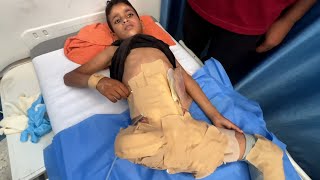 الطفل سند أبو سلعة ينتظر العلاج في الخارج بعد بتر ساقه وأعضائه التناسلية جراء القصف الإسرائيلي