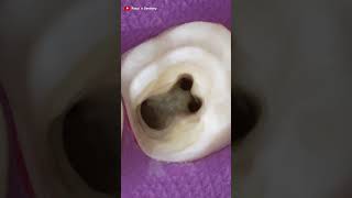 Wonderful Dentists Restoration! Dr.Rouf Ul Aziz #satisfying