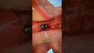 Lo que puede pasarte si tienes un mal día… y muy, muy mala suerte