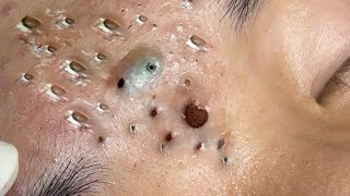 𝑭𝒓𝒐𝒎 𝑺𝒓𝒆𝒔𝒔𝒆𝒅 𝒕𝒐 𝑺𝒆𝒓𝒆𝒏𝒆 : 𝑯𝒐𝒘 𝒂 𝑹𝒆𝒍𝒂𝒙𝒊𝒏𝒈 𝑺𝒌𝒊𝒏𝒄𝒂𝒓𝒆 𝑹𝒐𝒖𝒕𝒊𝒏𝒆 𝑪𝒂𝒍𝒎𝒔 𝒀𝒐𝒖𝒓 𝑴𝒊𝒏𝒅 𝑨𝒏𝒅 𝑺𝒐𝒖𝒍 #𝟗𝟗𝟔𝟕𝟖