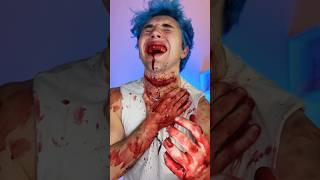 AYUDA!! Necesito una ambulancia🩸🚑💀