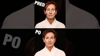 Zobral som mamu na plastickú operáciu (PRED A PO)