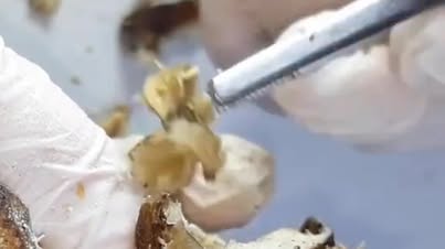 Ingrown Toenail removal🦶🏾🦶🏾 #trending #nails #nail #reelsviral #reelsvideos #Satisfying #pedicure