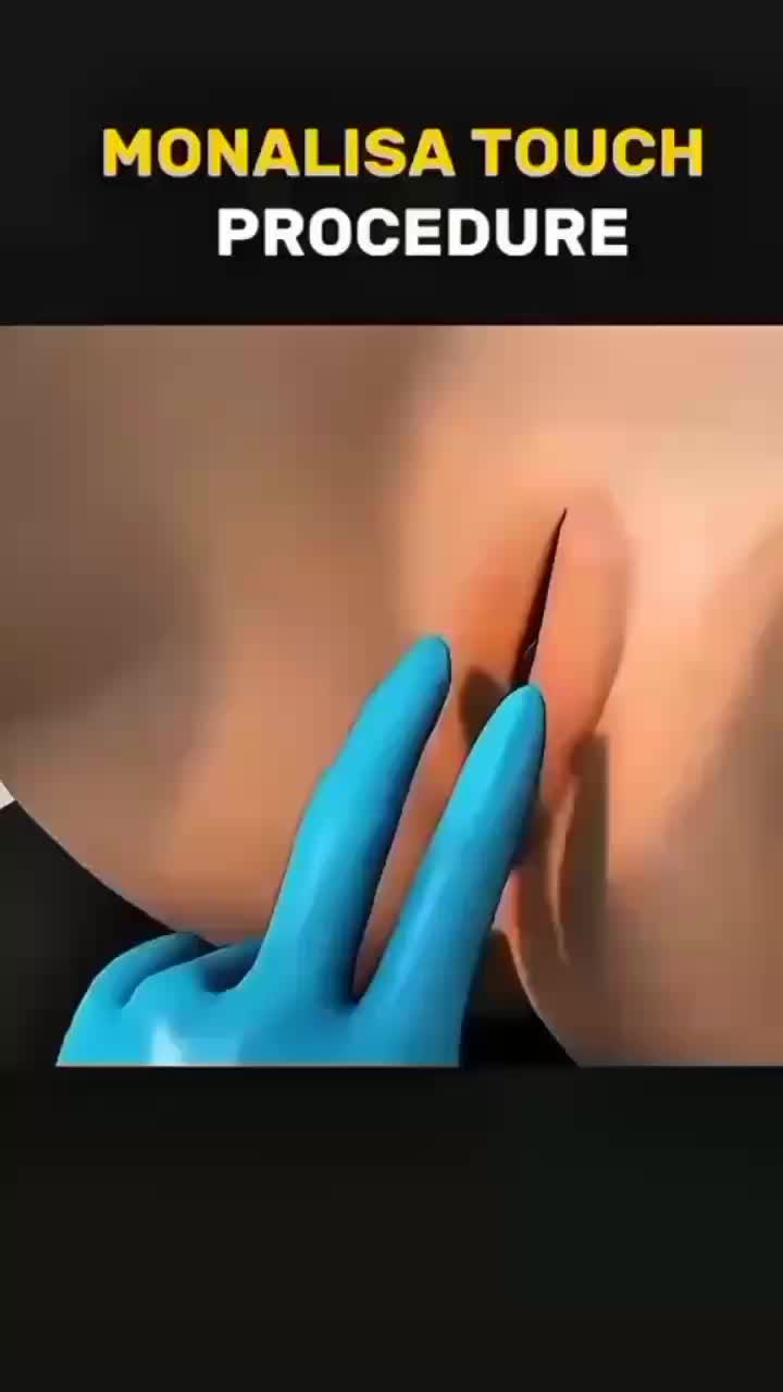 #fyppp #tiktok #viralvideo #foryou #top10 